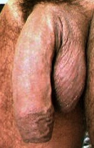 Juni98_1396(Thumbs(
