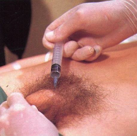 Local Anesthesia2 (Kopie)